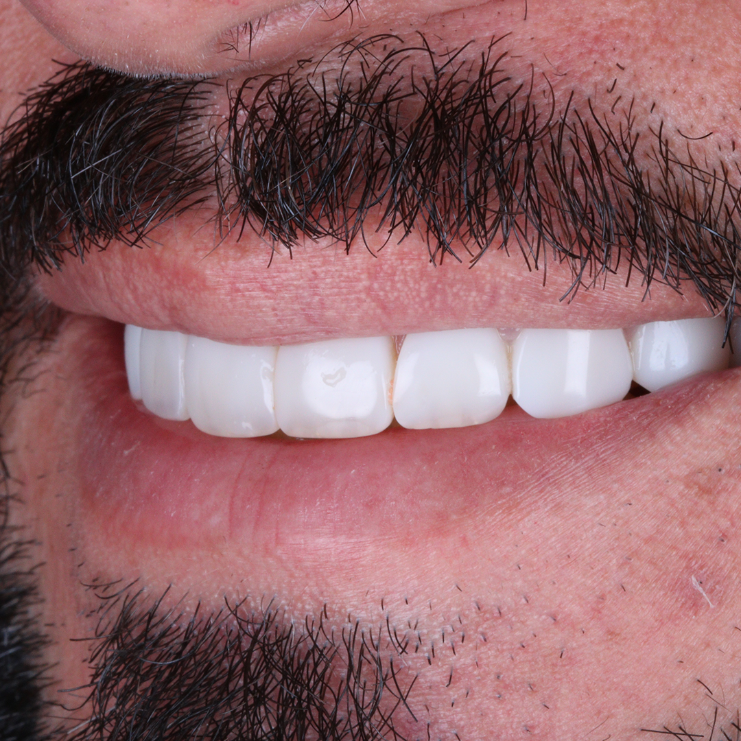 Caso de odontologia estética